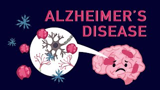 Pharmacology  DRUGS FOR ALZHEIMERS DISEASE MADE EASY [upl. by Lihas]