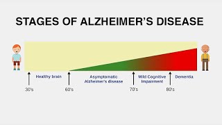 Diagnosing Alzheimer’s Disease [upl. by Notse]