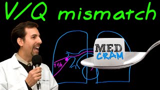 Ventilation Perfusion VQ Mismatch Explained Clearly [upl. by Ayikur]