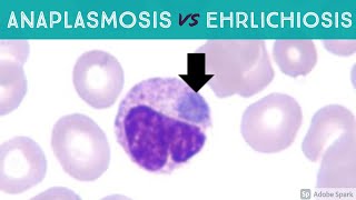 Anaplasmosis vs Ehrlichiosis Anaplasma phagocytophilum vs Ehrlichia chaffeensis amp ewingii [upl. by Archaimbaud]