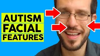 Autism Facial Feature  Aspergers Facial Characteristics [upl. by Miquela885]