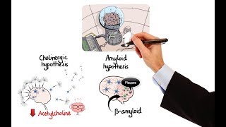 Alzheimers Disease The Basics  Being Patient [upl. by Lenhart]