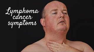 LYMPHOMA CANCER SYMPTOMS [upl. by Kciredec452]