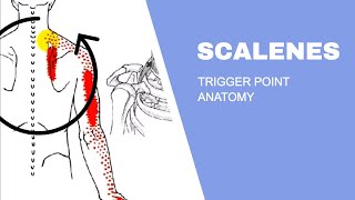 Scalenes Trigger Points [upl. by Htebazle6]