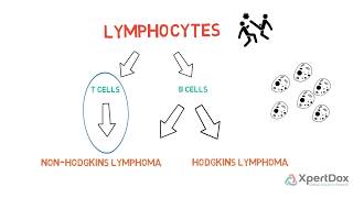 T Cell Lymphoma [upl. by Atteynod335]